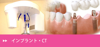 インプラント・CT