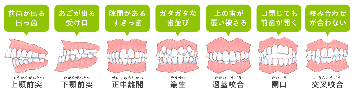 小児矯正歯科