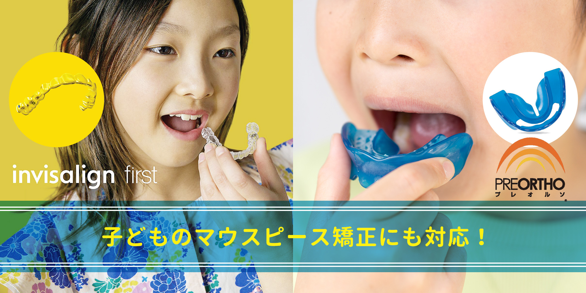 世田谷区 マウスピース矯正