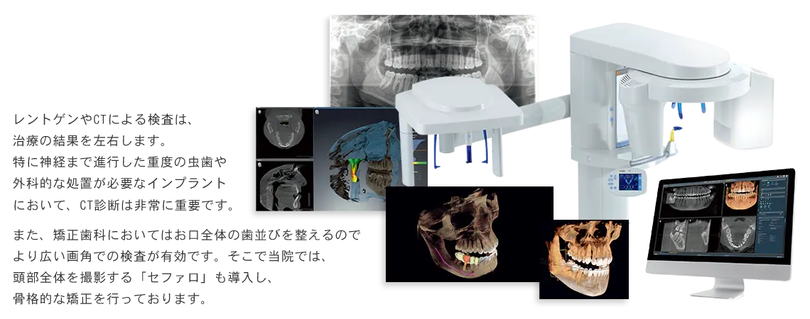 レントゲン・歯科用CT