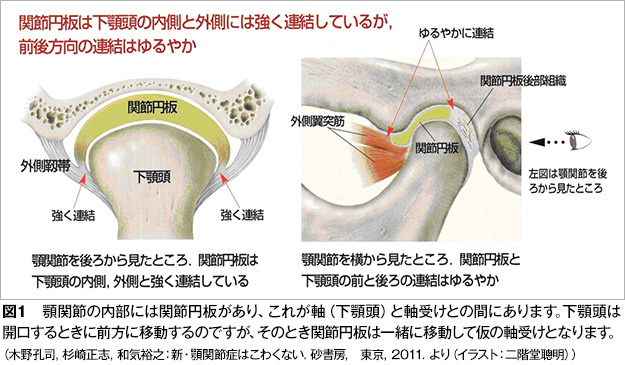 顎関節症はどんな状態になるのですか