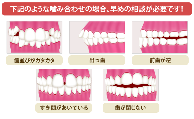 矯正歯科なら千歳船橋の歯科医院 歯医者 世田谷シティ歯科へ 矯正歯科 小児矯正歯科 マウスピース矯正対応の千歳船橋 祖師ヶ谷大蔵の歯科医院 歯医者