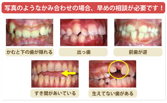 日本矯正歯科学会 認定医